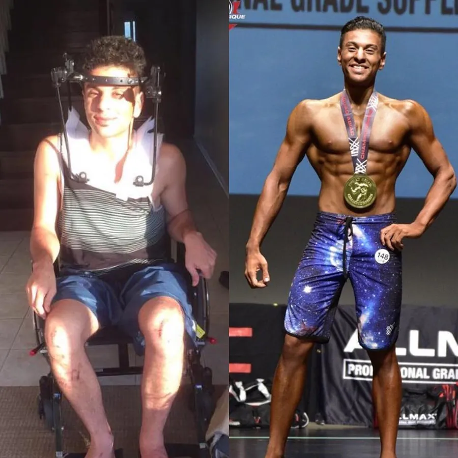 Adapted Physiques client result: From a wheelchair to the stage